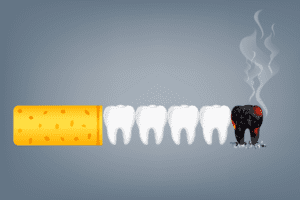 An illustration of how smoking affects the gums and teeth.