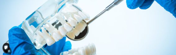 A Guide to Dental Implants – Crowns, Bridges and Implants