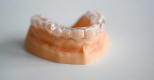 A teeth model with dental splint