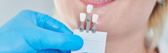 Can Veneers Be Replaced? When to Get a New Set