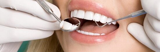 How Long Do Dental Veneers Last? (And How to Make Them Last Longer)