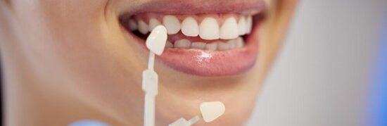 Porcelain vs Composite Veneers: Which Is Right for You?