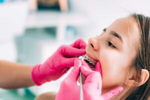 Child Orthodontic Assessments & Treatment on the Gold Coast