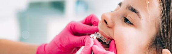 When Should Your Child Start Orthodontic Assessments?