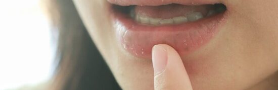 Dry Mouth (Xerostomia): Causes, Fixes and Tooth‑Friendly Products That Work
